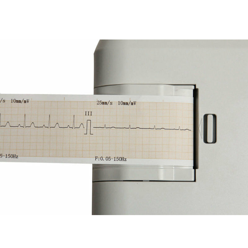 Pet シングルチャンネルポータブル ECG マシン ECG100G-VET