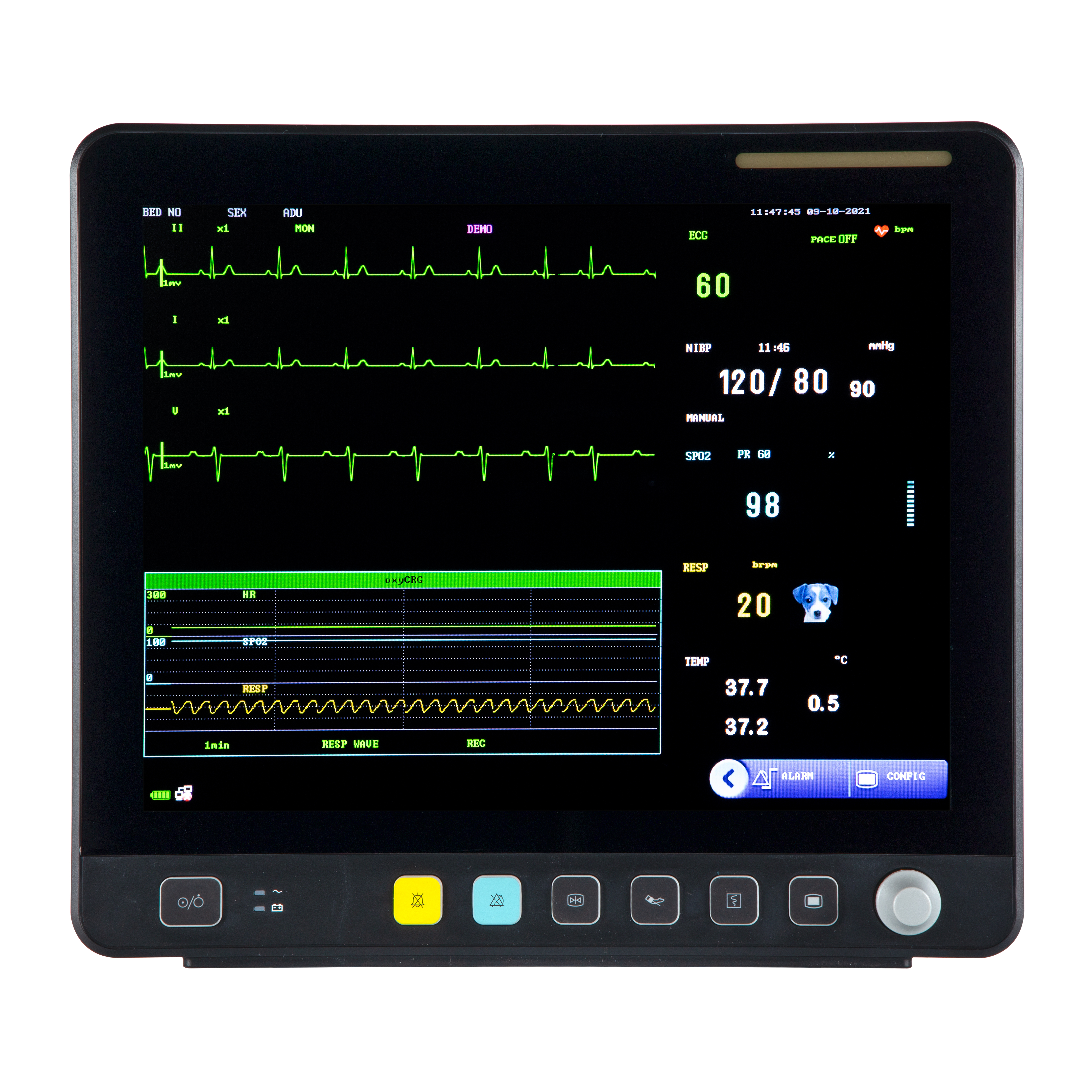 獣医用タッチ スクリーン マルチパラメータ ECG モニター VE15