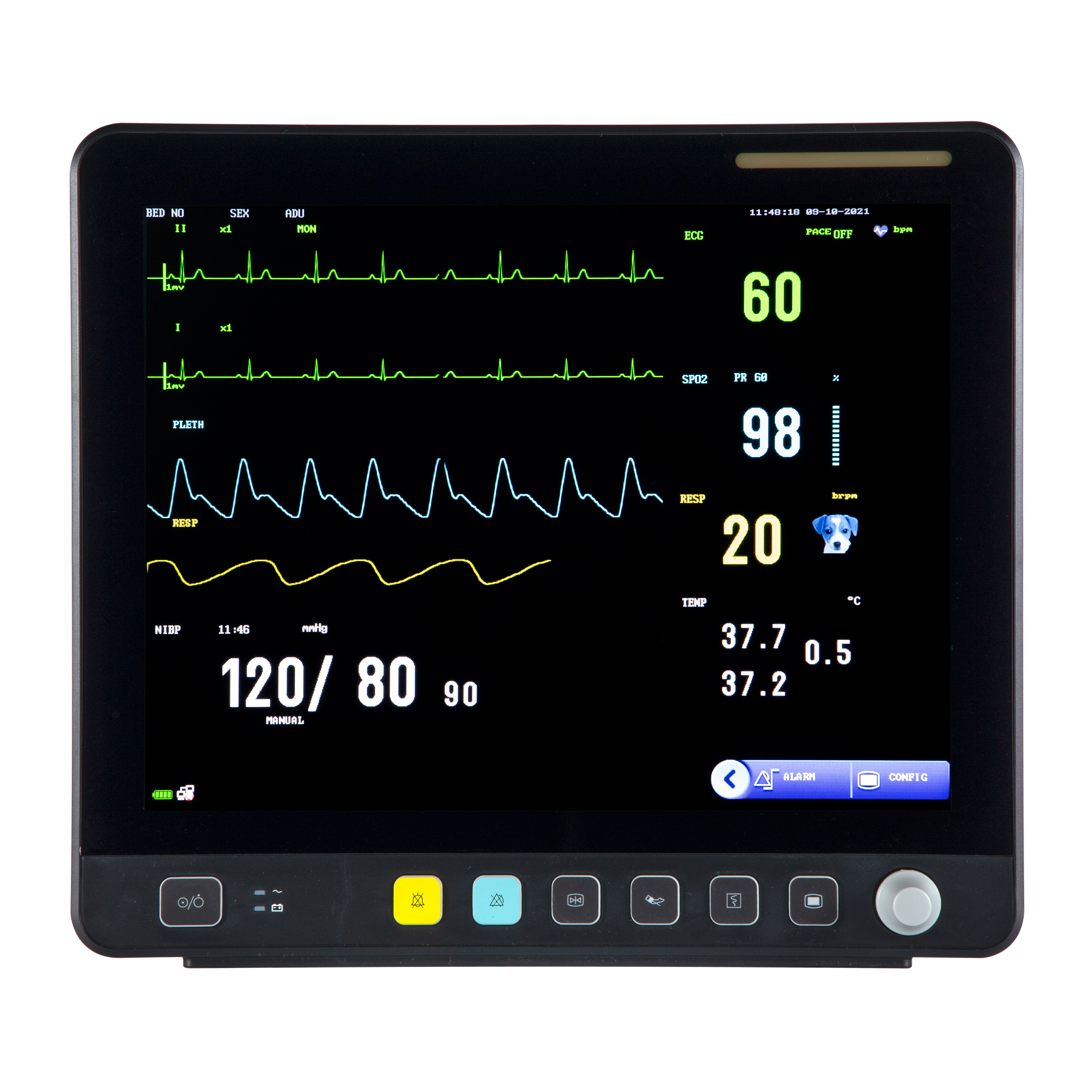 獣医用タッチ スクリーン マルチパラメータ ECG モニター VE15